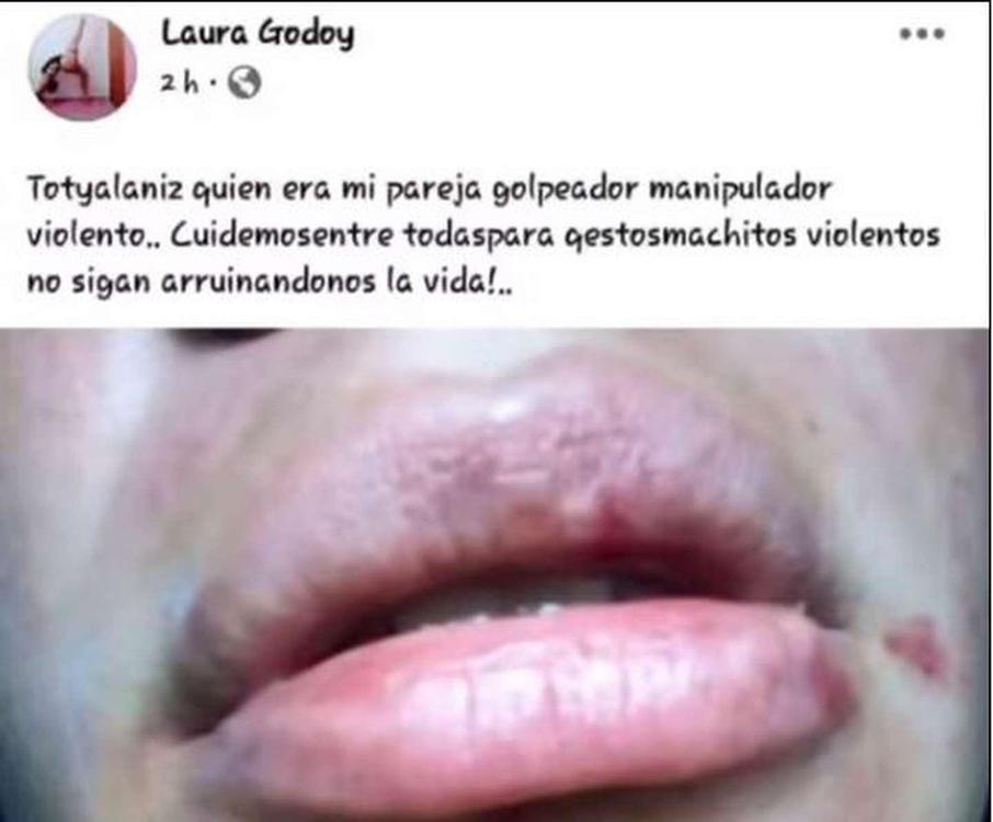 godoy_tilisarao