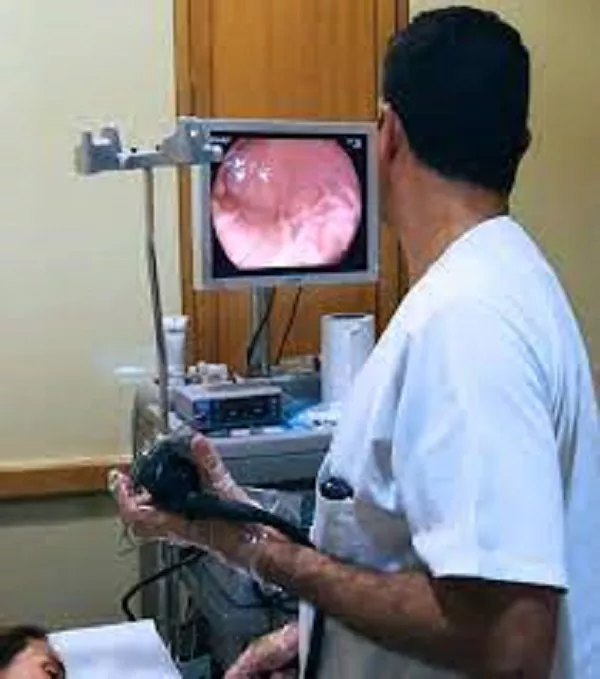 ENDOSCOPIA