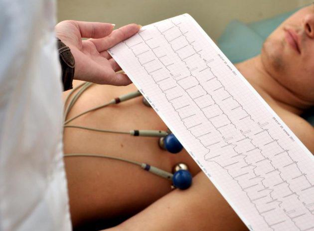 electrocardiograma