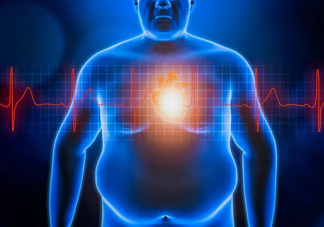 obesidad y cardio