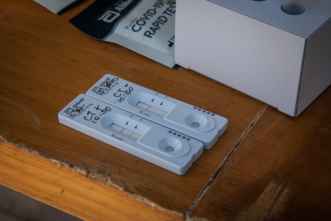 Las Heras realizará test anticuerpos a vecinos