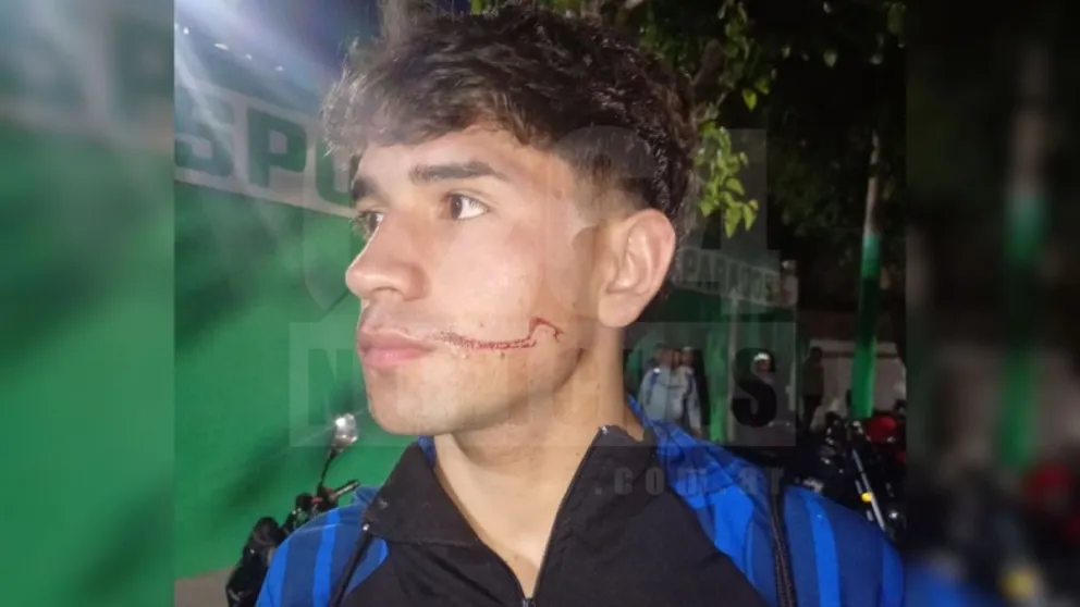 Futbol sanjuanino, agresiones a Unión Villa Krausse