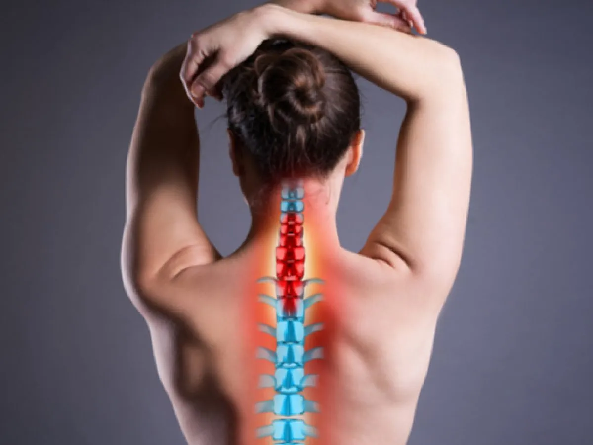 espondiloartritis (1)